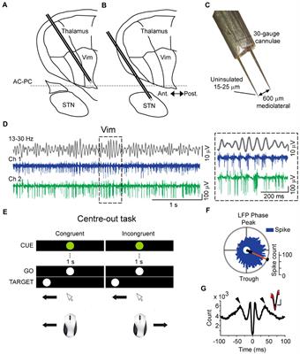 Beta band oscillations in the motor thalamus are modulated by visuomotor coordination in essential tremor patients